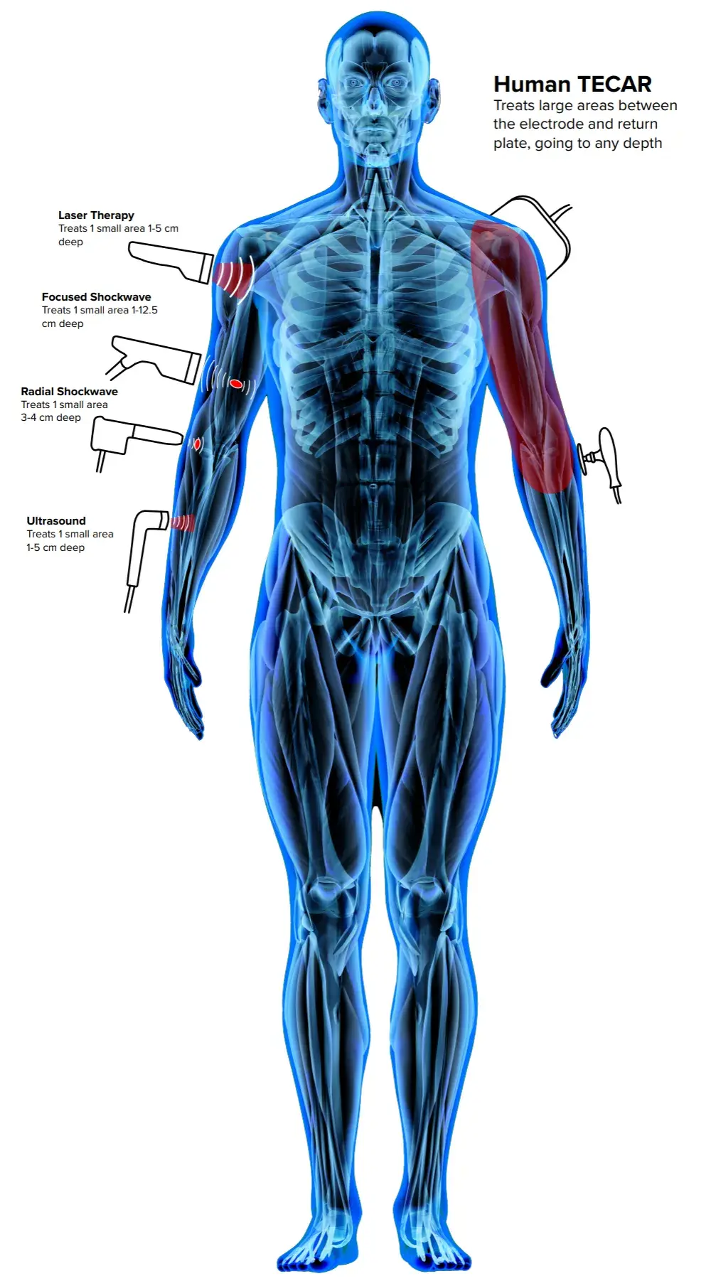 body-tecar-difference